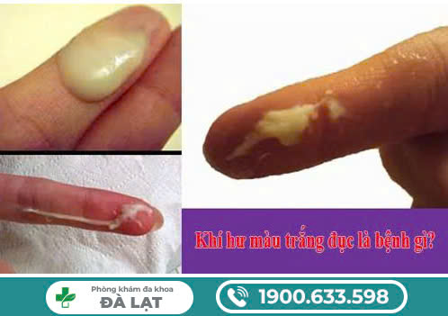 Hình ảnh minh họa